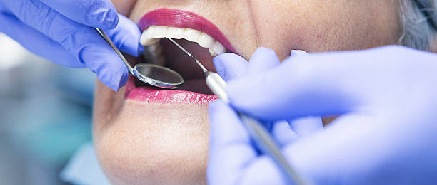 Best Broken or Cracked Tooth Emergency Dentist in Lebanon, MO
